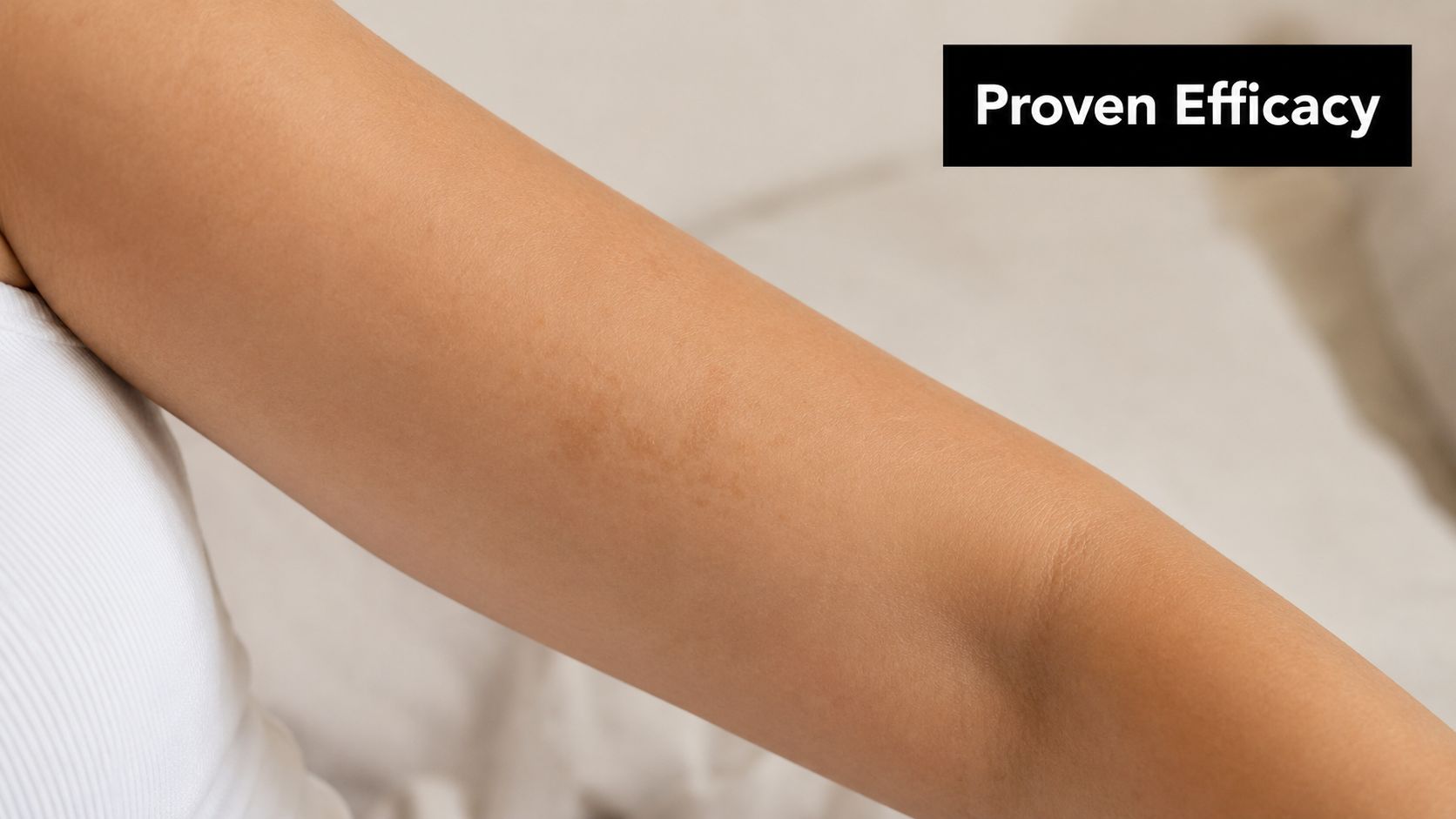 Close-up of a person's upper arm showing a patch of skin hyperpigmentation, with a text overlay.